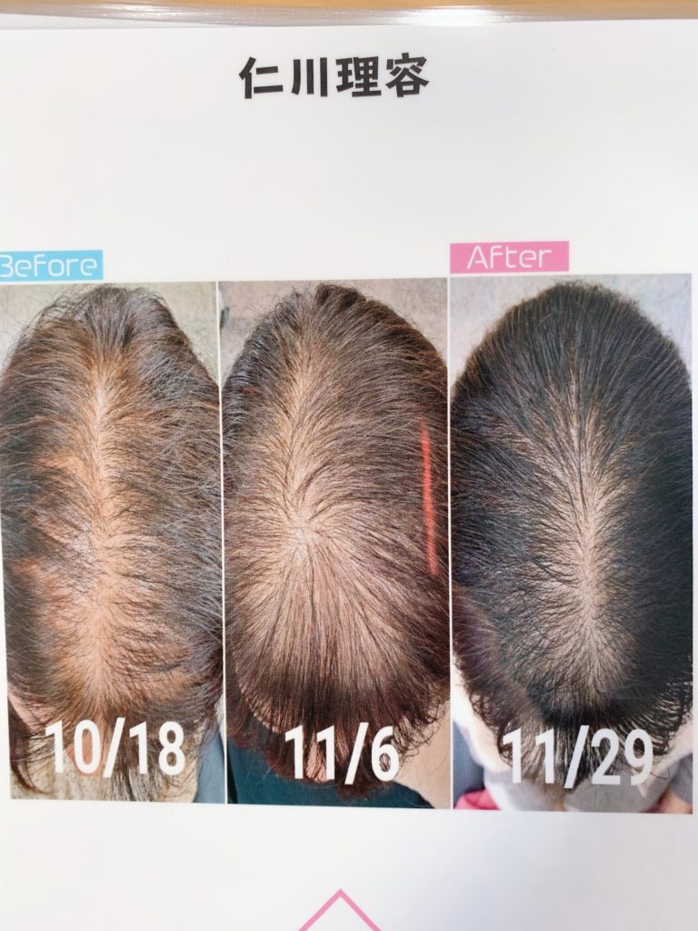 強髪」は薄毛改善・ボリュームアップの魔法のメニュー♪ 京都・四条大宮「Lien」 髪のダメージを最大限に抑えられる本格ヘアサロン